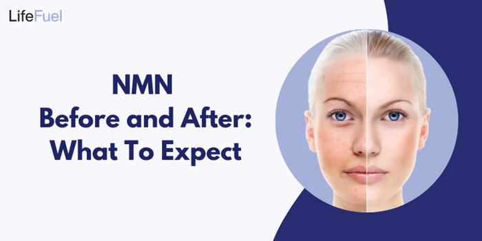 NMN Before and After